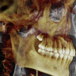 A tooth with the facebook logo on it.