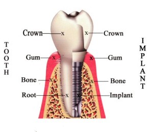 A tooth with the facebook logo on it.