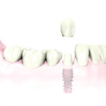 A tooth with the facebook logo on it.